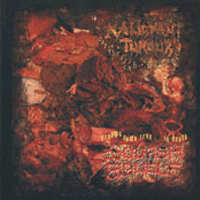 Malignant tumour/Squash bowels - Split